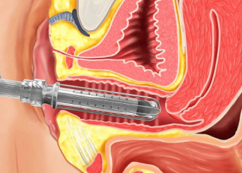 Vajina Daraltma Lazerle Yapılır mı?
